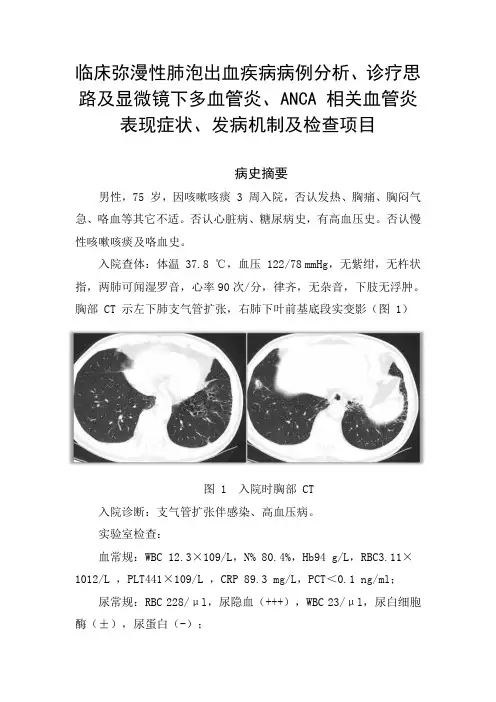 临床弥漫性肺泡出血疾病诊疗思路及显微镜下多血管炎、ANCA-相关血管炎表现症状、发病机制及检查项目