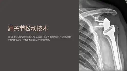 《肩关节松动技术》课件