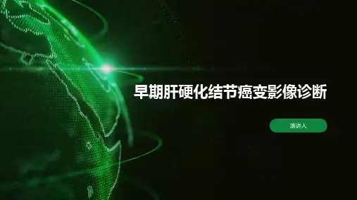 早期肝硬化结节癌变影像诊断