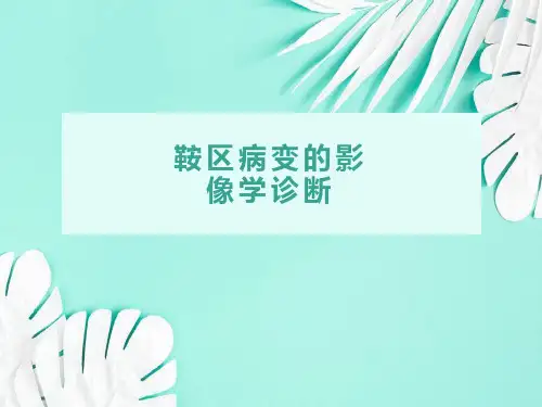 鞍区病变的影像学诊断