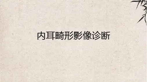 内耳畸形影像诊断