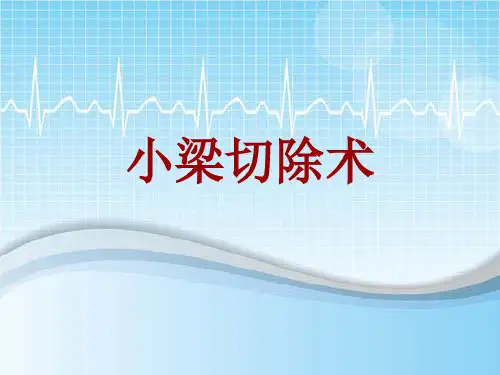 外科手术教学资料：小梁切除术讲解模板