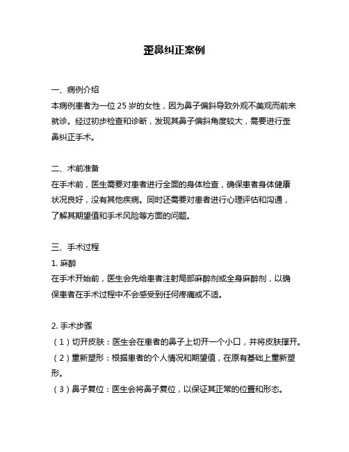 歪鼻纠正案例