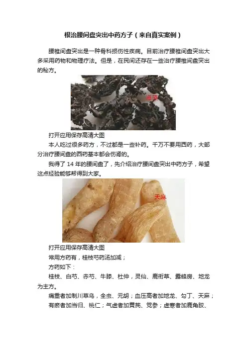 根治腰间盘突出中药方子（来自真实案例）