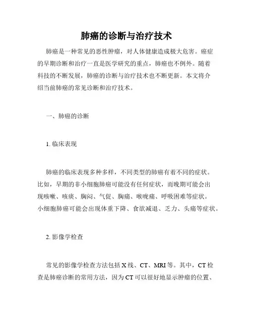 肺癌的诊断与治疗技术