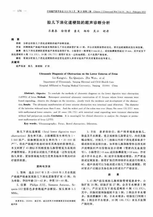 胎儿下消化道梗阻的超声诊断分析