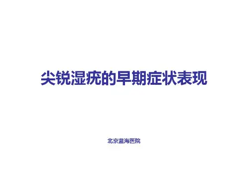 尖锐湿疣的早期症状表现