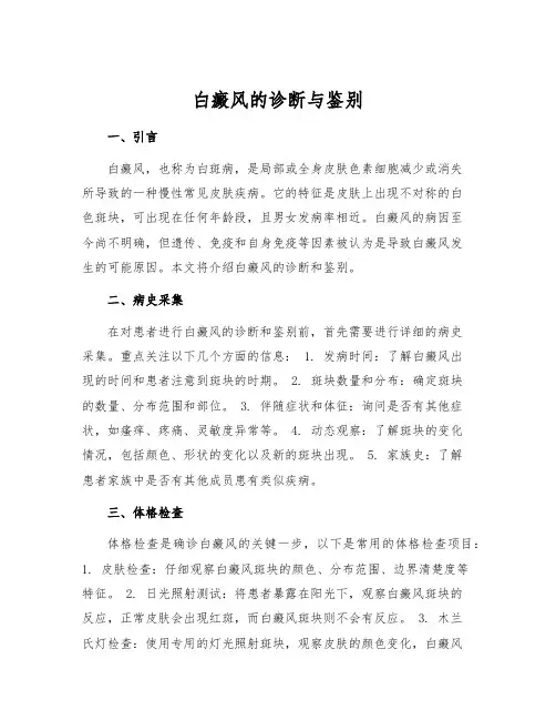 白癜风的诊断与鉴别