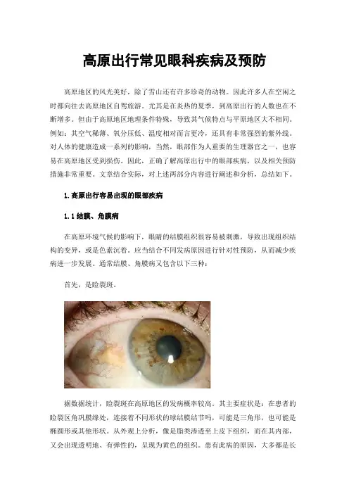 高原出行常见眼科疾病及预防
