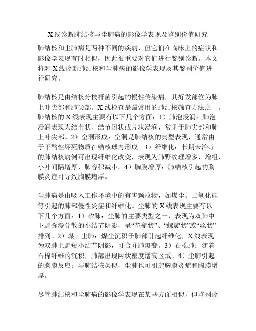 X线诊断肺结核与尘肺病的影像学表现及鉴别价值研究
