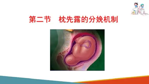 分娩期妇女的护理 枕先露的分娩机制(母婴护理课件)