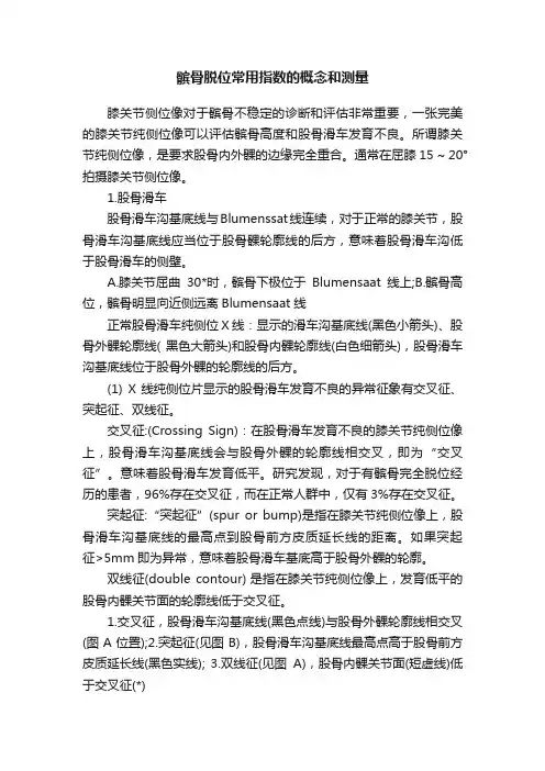 髌骨脱位常用指数的概念和测量