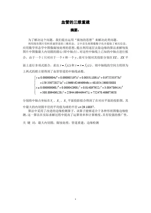 血管重建