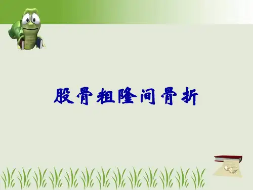 股骨粗隆间骨折