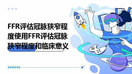 FFR评估冠脉狭窄程度使用FFR评估冠脉狭窄程度和临床意义