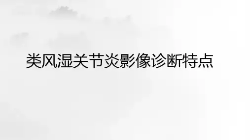 类风湿关节炎影像诊断特点