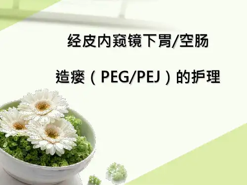 经皮内窥镜下胃空肠造瘘(PEGPEJ)的护理