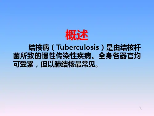 小儿结核病幻灯片PPT课件