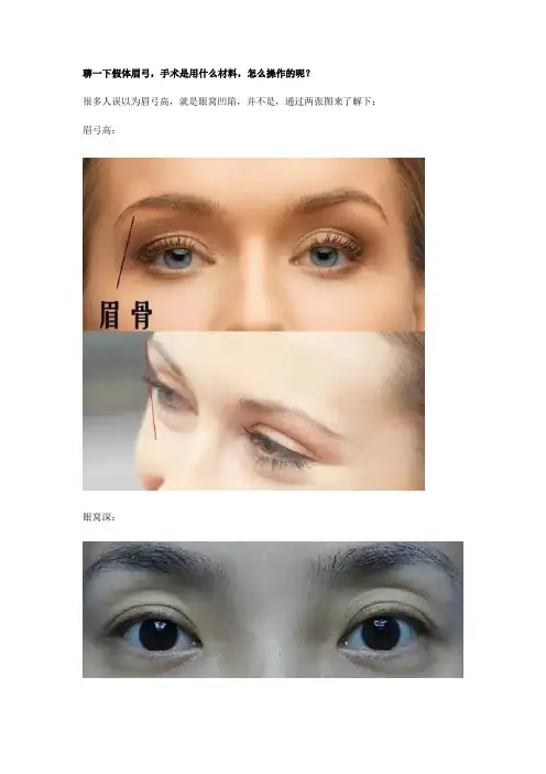 聊一下假体眉弓,手术是用什么材料,怎么操作的呢