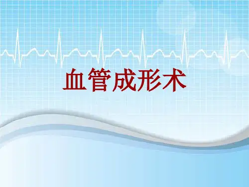 手术讲解模板：血管成形术