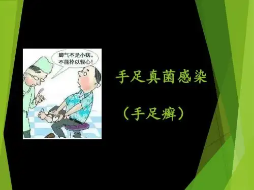 手足癣
