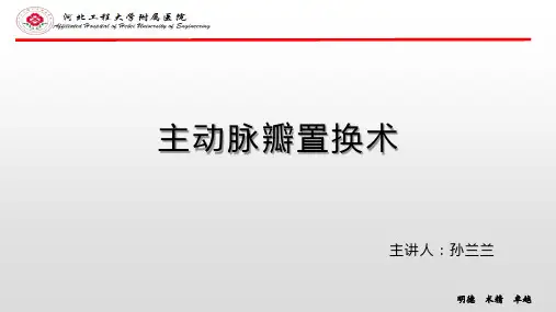 主动脉瓣置换术