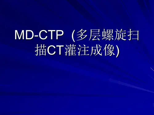 灌注成像