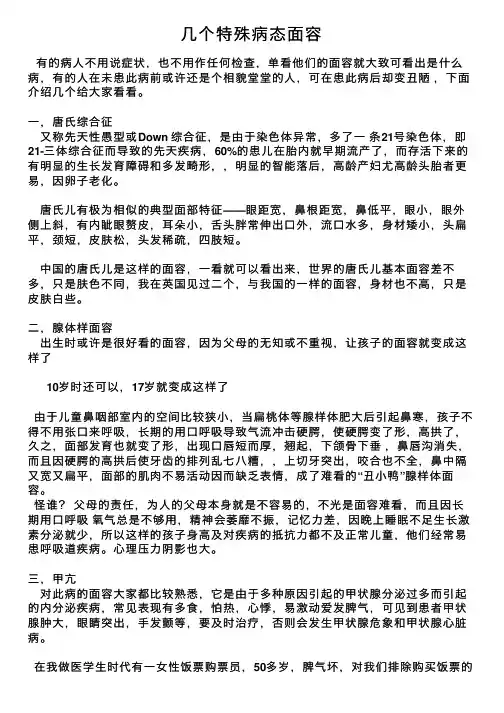 几个特殊病态面容