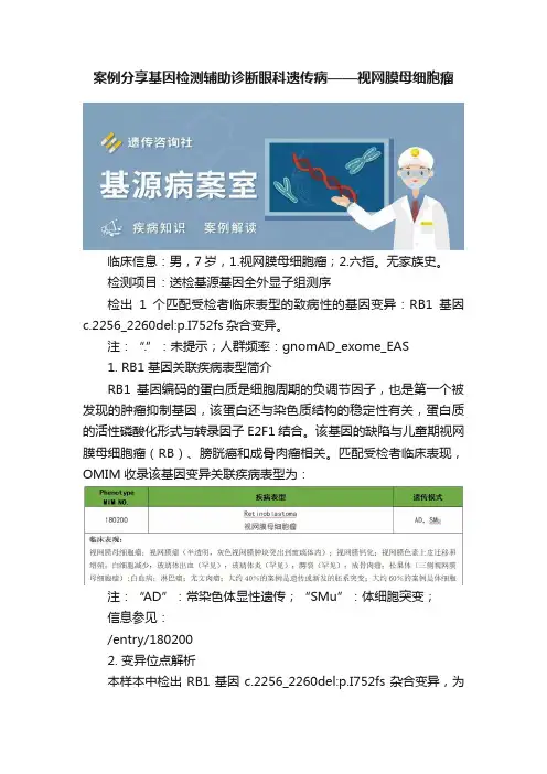 案例分享基因检测辅助诊断眼科遗传病——视网膜母细胞瘤