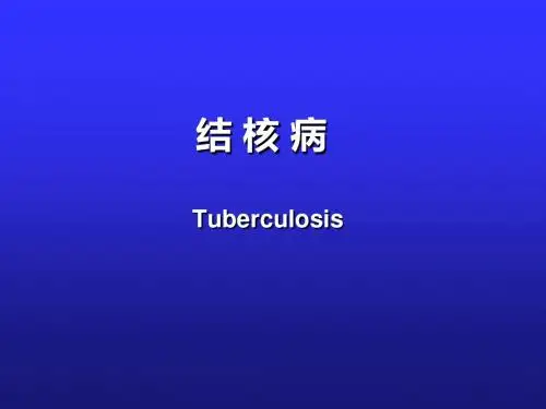 结核病ppt课件