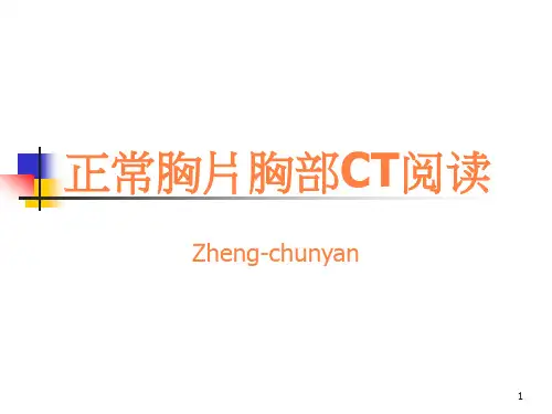 正常胸片胸部C阅读ppt课件