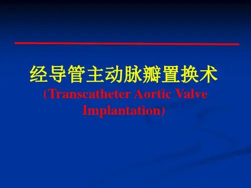 经导管主动脉瓣置换术课件