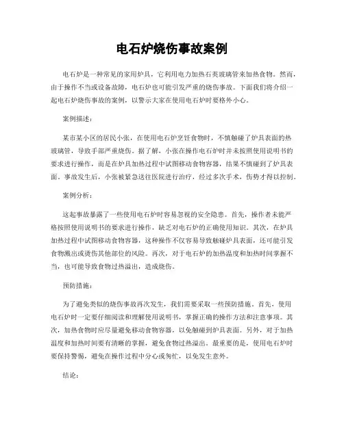 电石炉烧伤事故案例