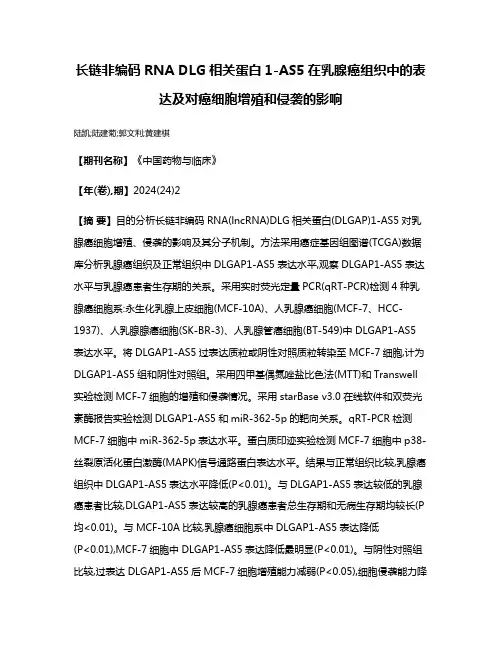 长链非编码RNA DLG相关蛋白1-AS5在乳腺癌组织中的表达及对癌细胞增殖和侵袭的影响