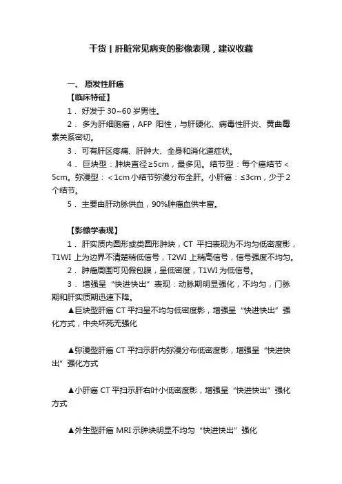 干货丨肝脏常见病变的影像表现，建议收藏
