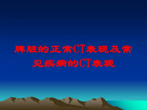 脾脏的正常CT表现及常见疾病的CT表现培训课件
