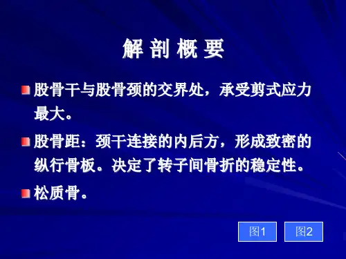 股骨转子间骨折概论