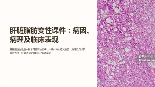 肝脏脂肪变性课件：病因、病理及临床表现