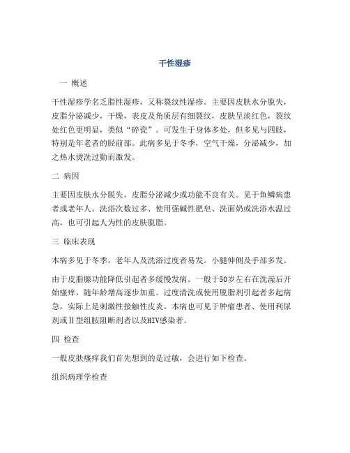 医学知识之干性湿疹