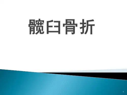 髋臼骨折PPT课件