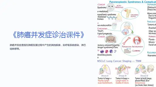 《肺癌并发症诊治课件》