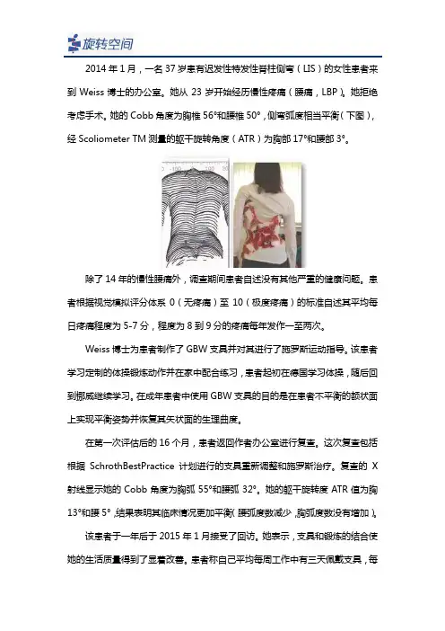 成年人脊柱侧弯可以佩戴施罗斯支具进行校正吗