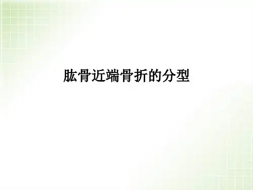 肱骨近端骨折分型课件