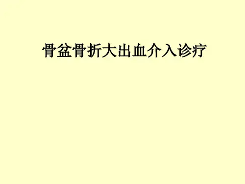 骨盆骨折大出血介入诊疗