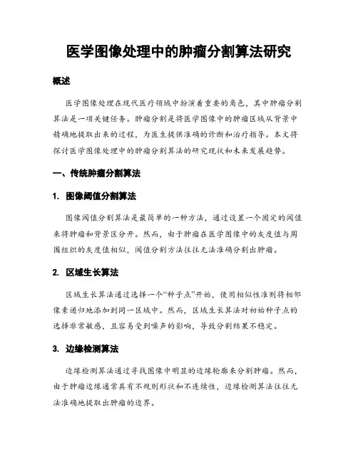 医学图像处理中的肿瘤分割算法研究