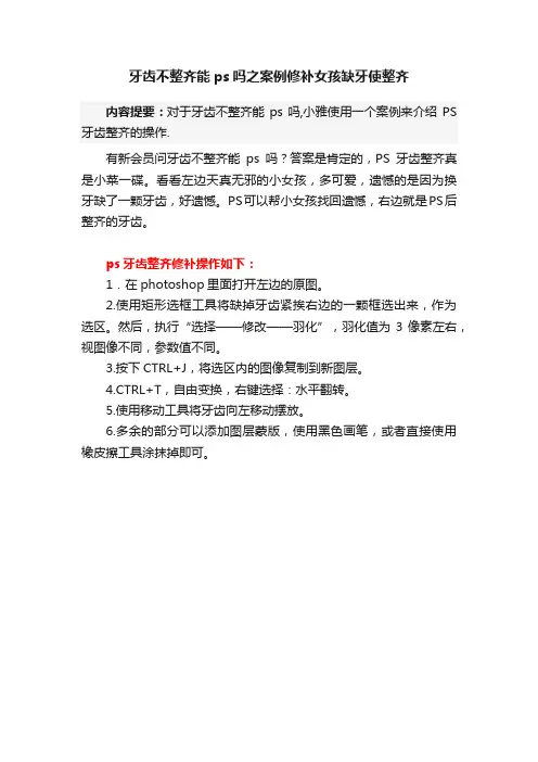 牙齿不整齐能ps吗之案例修补女孩缺牙使整齐