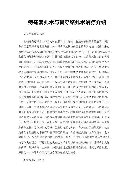 痔疮套扎术与贯穿结扎术治疗介绍