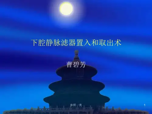 下腔静脉滤器植入、取出术规范(优质荟萃)