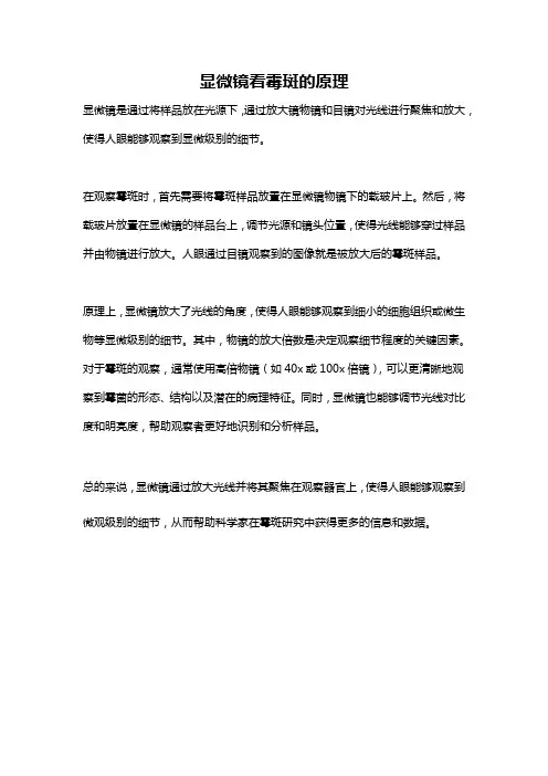 显微镜看霉斑的原理