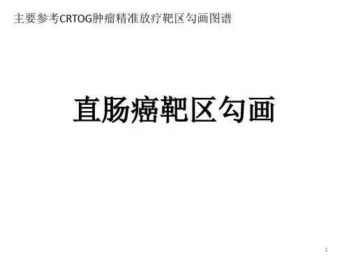 (医学课件)直肠癌放疗靶区勾画